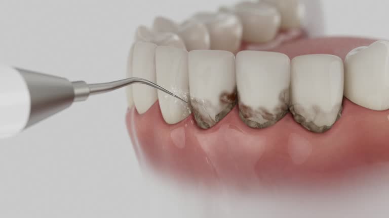 Trusted Root Canal Treatment service in Biddeford, ME - Dentist Open Now